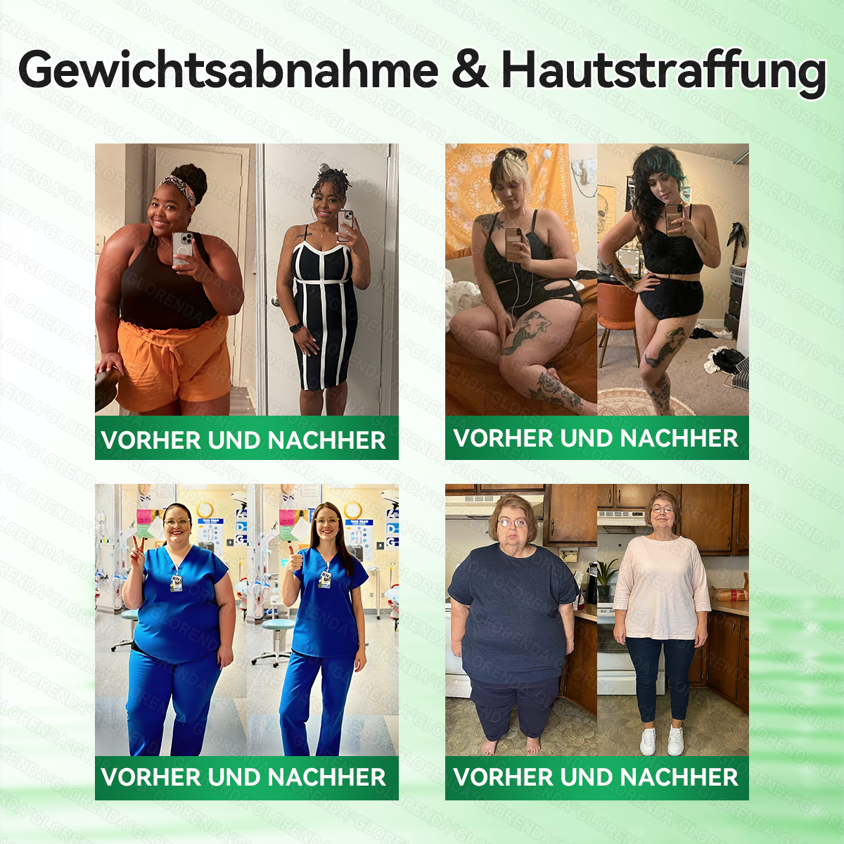 🇩🇪𝐎𝐟𝐟𝐢𝐳𝐢𝐞𝐥𝐥𝐞𝐫 𝐒𝐡𝐨𝐩 |🌸𝑮𝑳𝑶𝐑𝐄𝐍𝐃𝘼®10-𝙞𝙣-𝟏 𝐀𝐝𝐯𝐚𝗻𝗰𝗲𝗱 𝗡𝗮𝙣𝙤 𝙈𝙞𝙠𝙧𝐨𝐧𝐚𝐝𝐞𝐥-𝐏𝐚𝒕𝒄𝗵