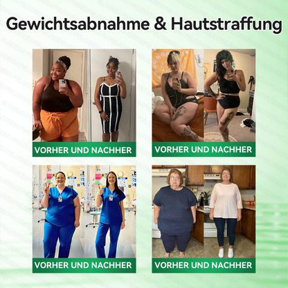 🇩🇪𝐎𝐟𝐟𝐢𝐳𝐢𝐞𝐥𝐥𝐞𝐫 𝐒𝐡𝐨𝐩 | 👩‍⚕️👩‍⚕️💃 𝑮𝑳𝑶𝐑𝐄𝐍𝐃𝘼®10-𝙞𝙣-𝟏 𝐀𝐝𝐯𝐚𝗻𝗰𝗲𝗱 𝗡𝗮𝙣𝙤 𝙈𝙞𝙠𝙧𝐨𝐧𝐚𝐝𝐞𝐥-𝐏𝐚𝒕𝒄𝗵