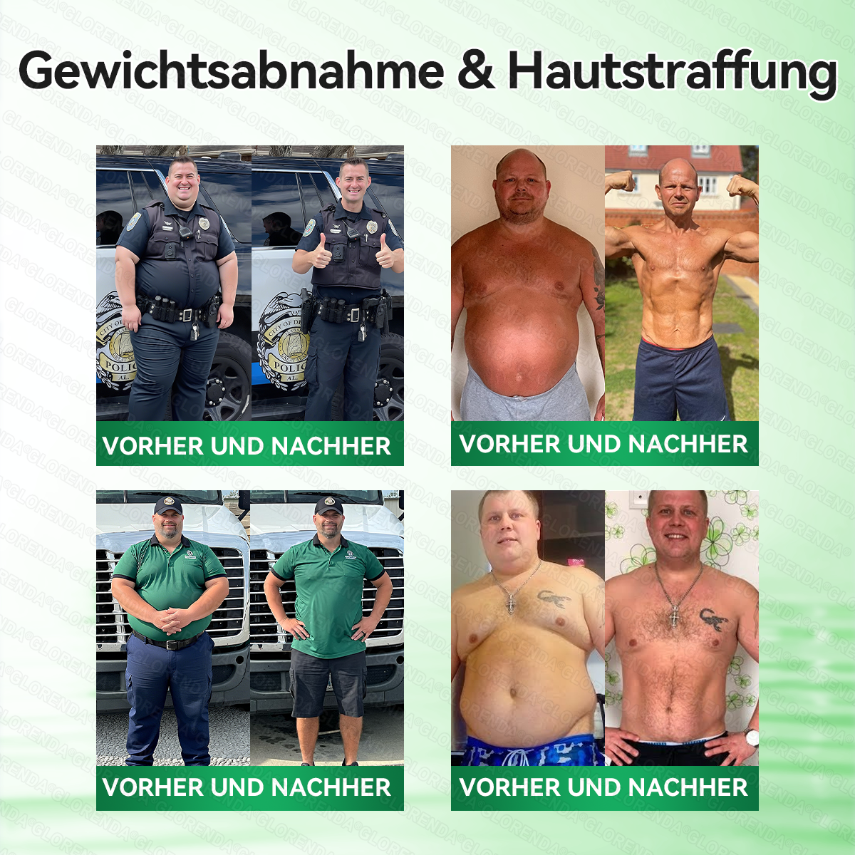 🇩🇪𝐎𝐟𝐟𝐢𝐳𝐢𝐞𝐥𝐥𝐞𝐫 𝐒𝐡𝐨𝐩 | 🧸🧸💃 𝑮𝑳𝑶𝐑𝐄𝐍𝐃𝘼®10-𝙞𝙣-𝟏 𝐀𝐝𝐯𝐚𝗻𝗰𝗲𝗱 𝗡𝗮𝙣𝙤 𝙈𝙞𝙠𝙧𝐨𝐧𝐚𝐝𝐞𝐥-𝐏𝐚𝒕𝒄𝗵